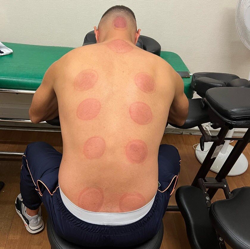 karim-benzema-a-souvent-recours-a-cette-pratique-pour-se-soigner-photo-capture-d-ecran-instagram-karim-benzema-1666102193